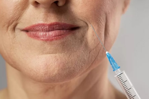 Botox Treatment
