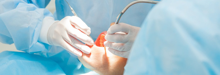 Flap Surgeries