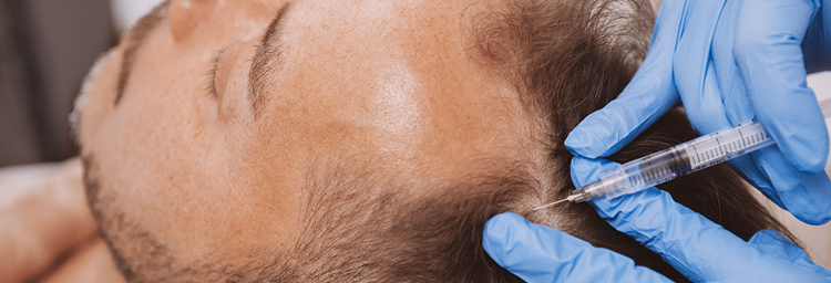 Hair Loss Treatment / Hair Regrowth Therapy