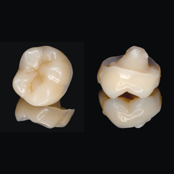RESTORATION OF ENDODONTICALLY TEETH