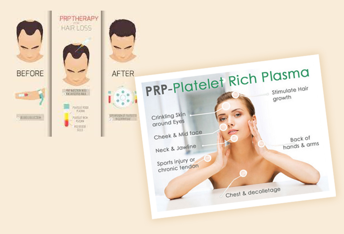PRP & GFC