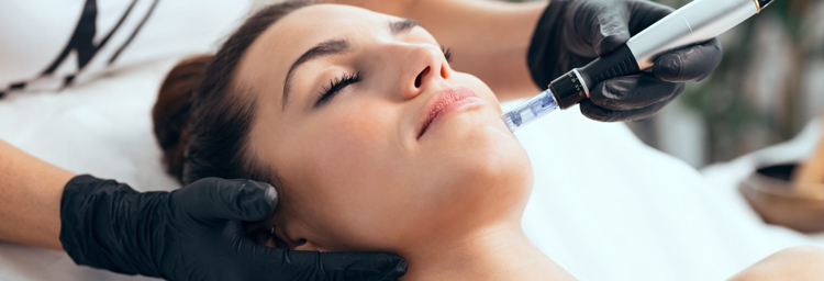 Microneedling