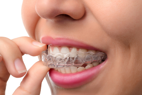 Orthodontic Treatment