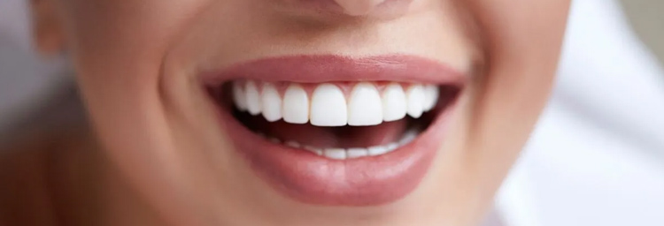Smile Design