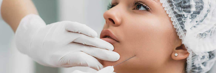 Thread Lift Treatment