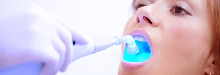 Tooth Bleaching