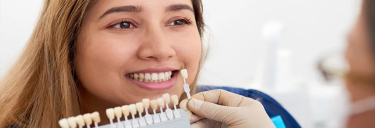 Veneers
